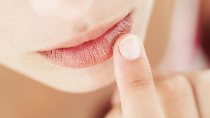 Liếm môi gây nứt nẻ môi